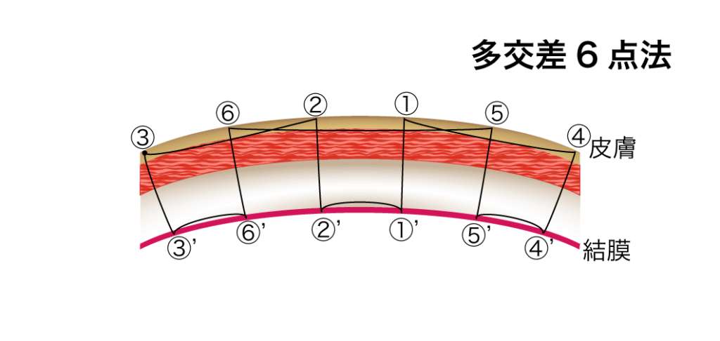 多交差6点法模式図