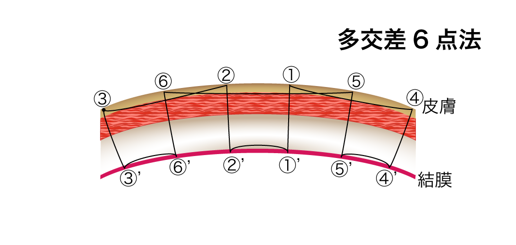 多交差6点法模式図